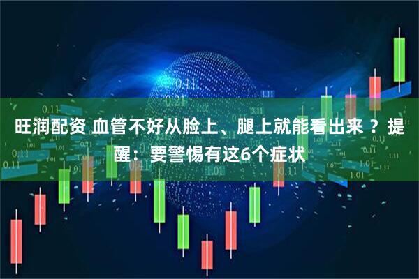 旺润配资 血管不好从脸上、腿上就能看出来 ？提醒：要警惕有这6个症状